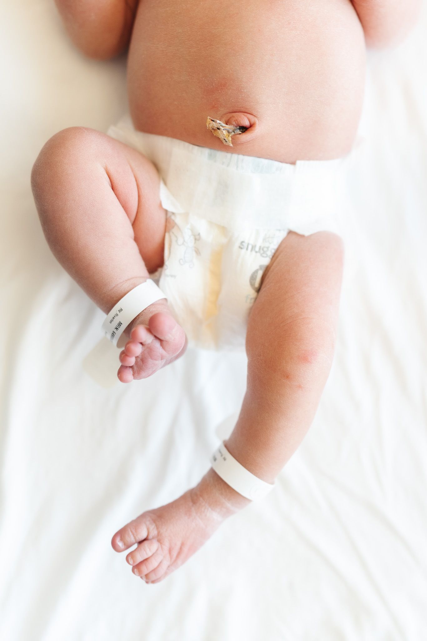 Newborn baby lying on white blanket wearing diaper with umbilical cord clamp and hospital identification wristbands.