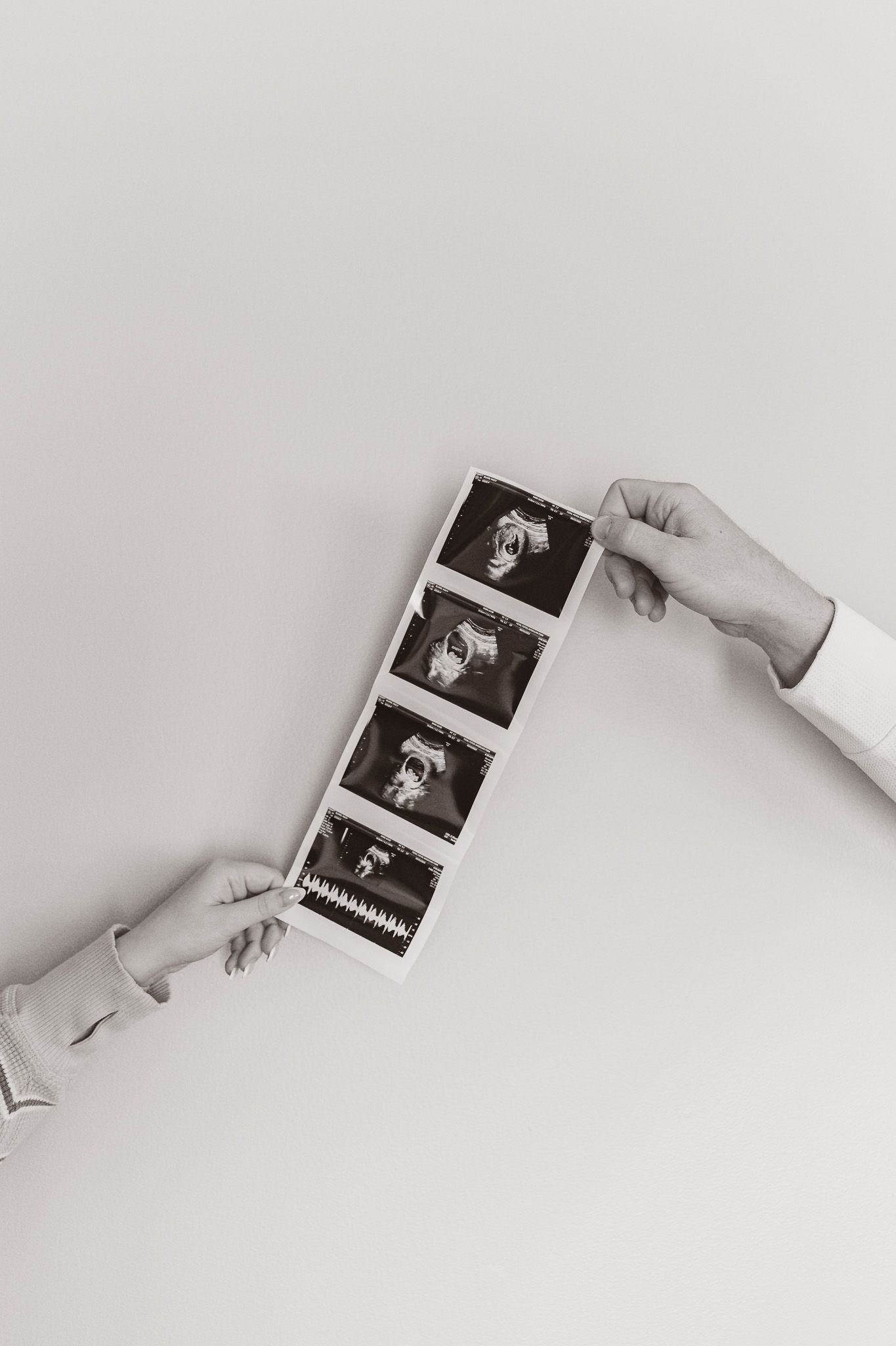 Black and white ultrasound photos being held against white background.