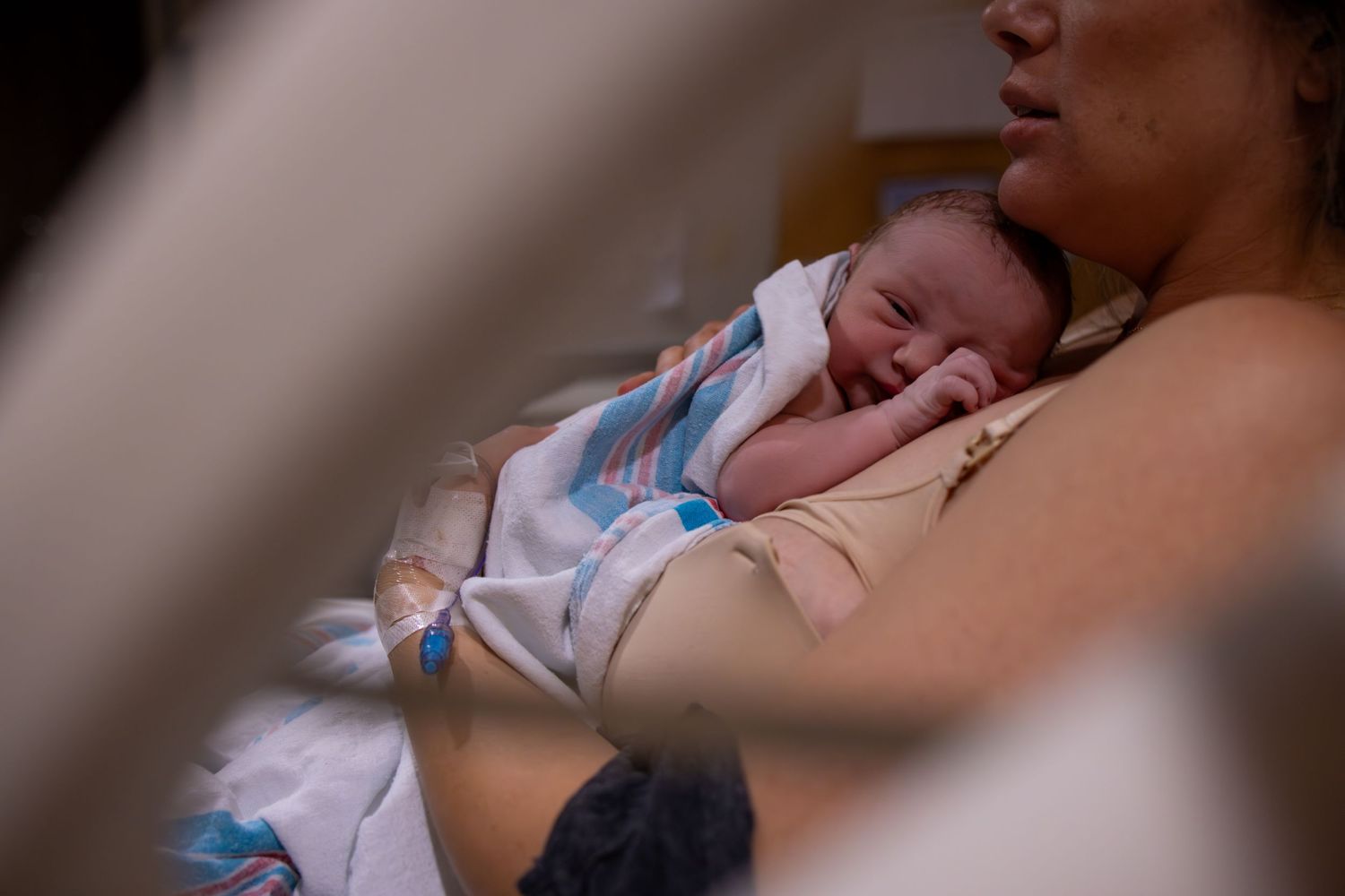 Close-up view of someone resting on a hospital bed during a medical procedure. Kansas birth photographer capturing labor and delivery
