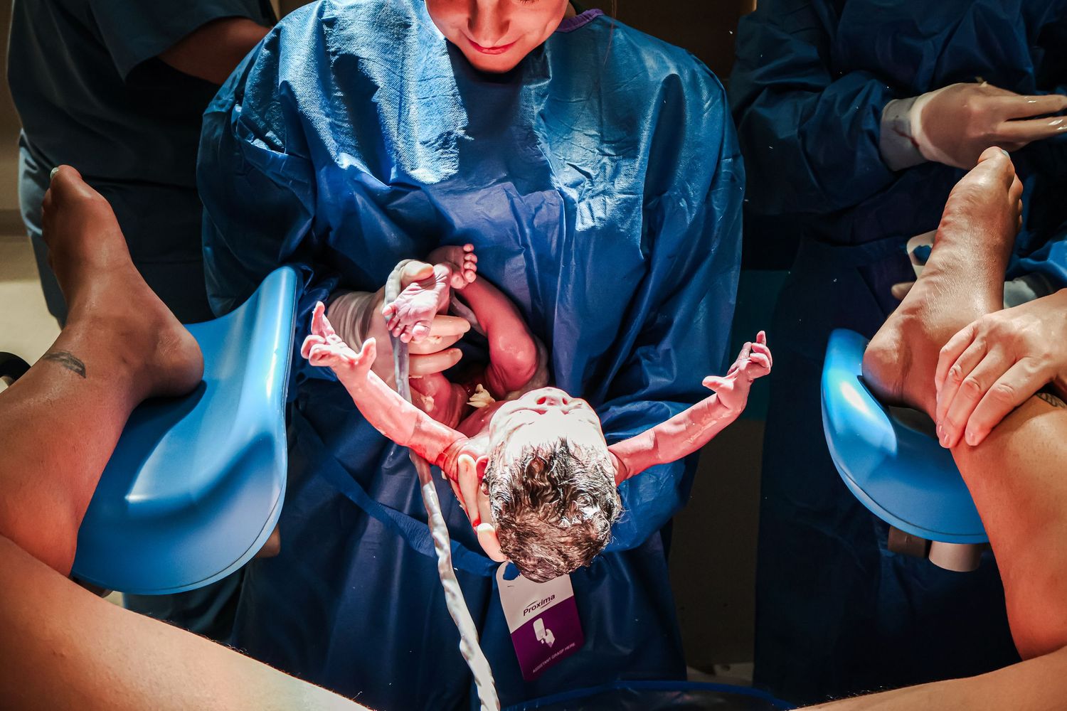 Medical staff in blue scrubs attending to patient during delivery.