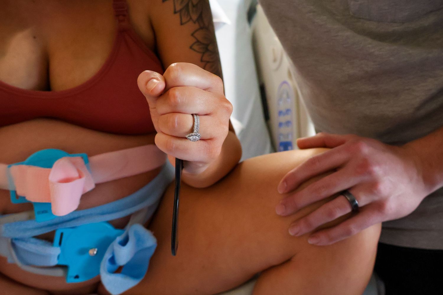 Close up of medical procedures being performed during childbirth.