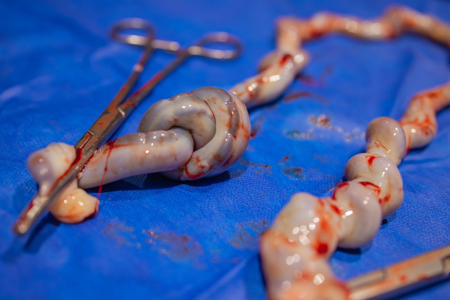 Medical instruments laid out on bright blue surgical draping. Birth photography in Wichita Kansas