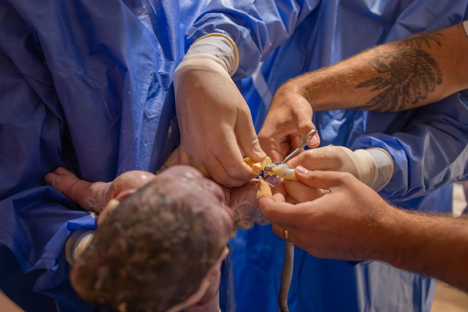 Medical staff in blue scrubs handling equipment during a procedure. Birth photography in Wichita Kansas
