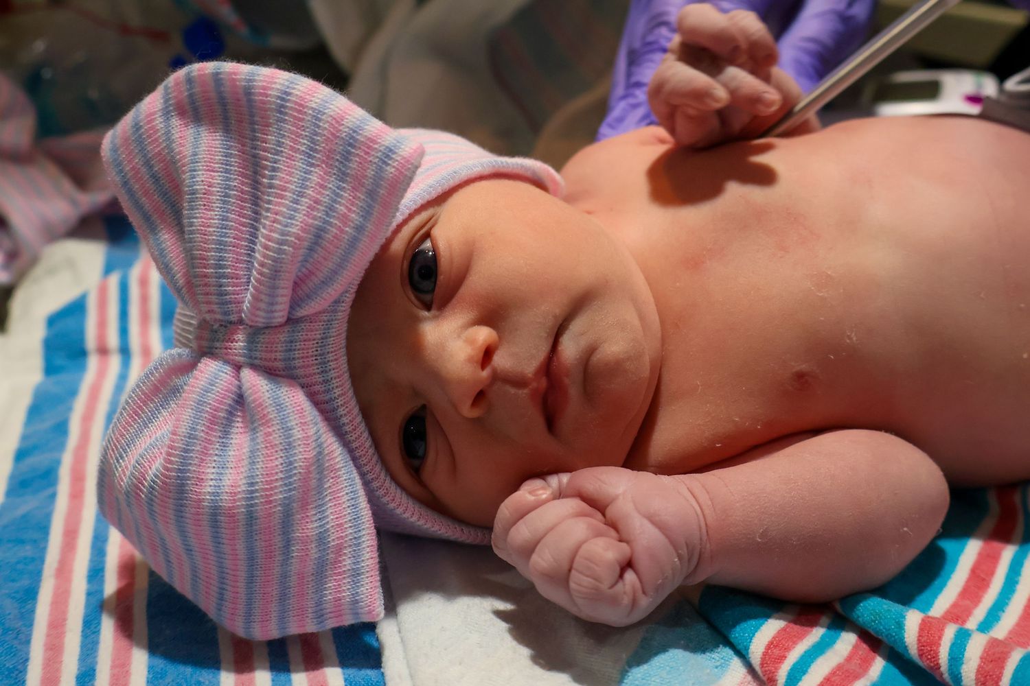 Newborn baby wrapped in striped hospital blanket lying on medical bed.