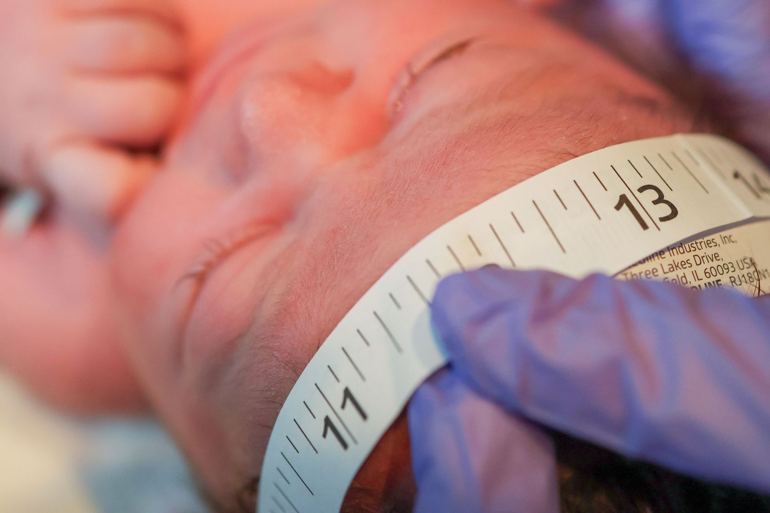 Close-up measurement being taken during a medical procedure.