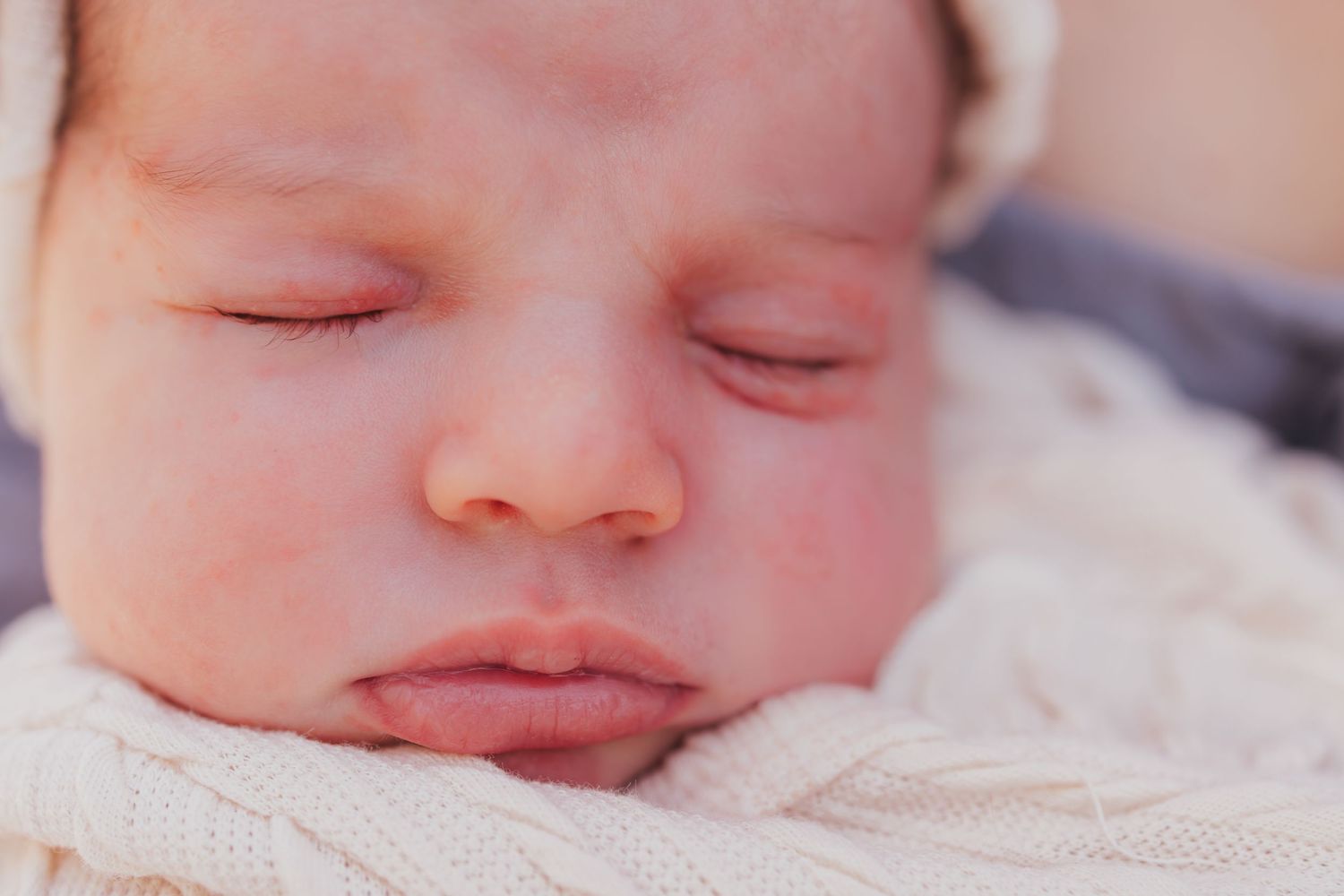 Close-up view of a sleeping newborn baby's face against white fabric. Wichita newborn photographer in-home session