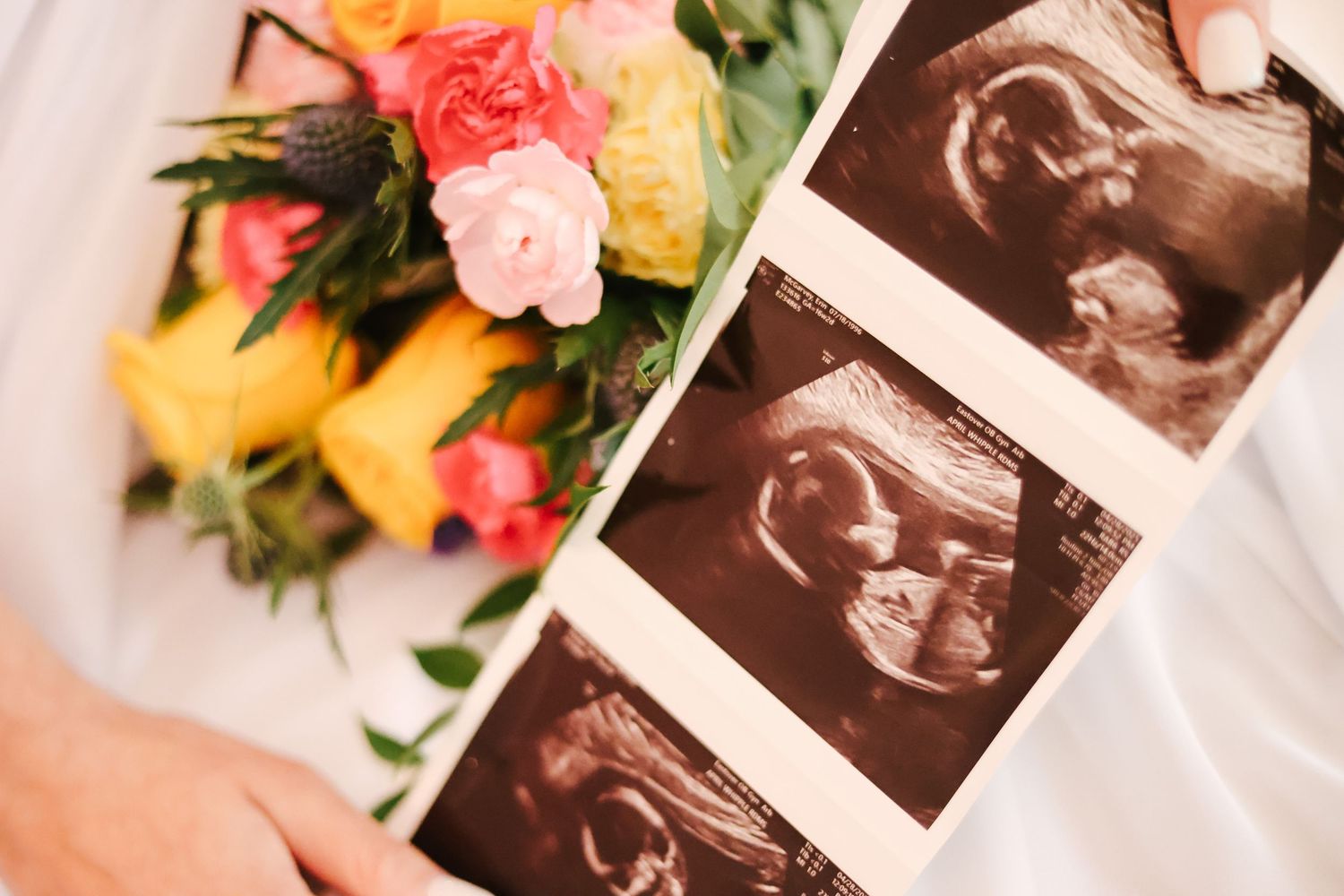 Four ultrasound photos displayed with colorful flowers in a pregnancy announcement style layout.