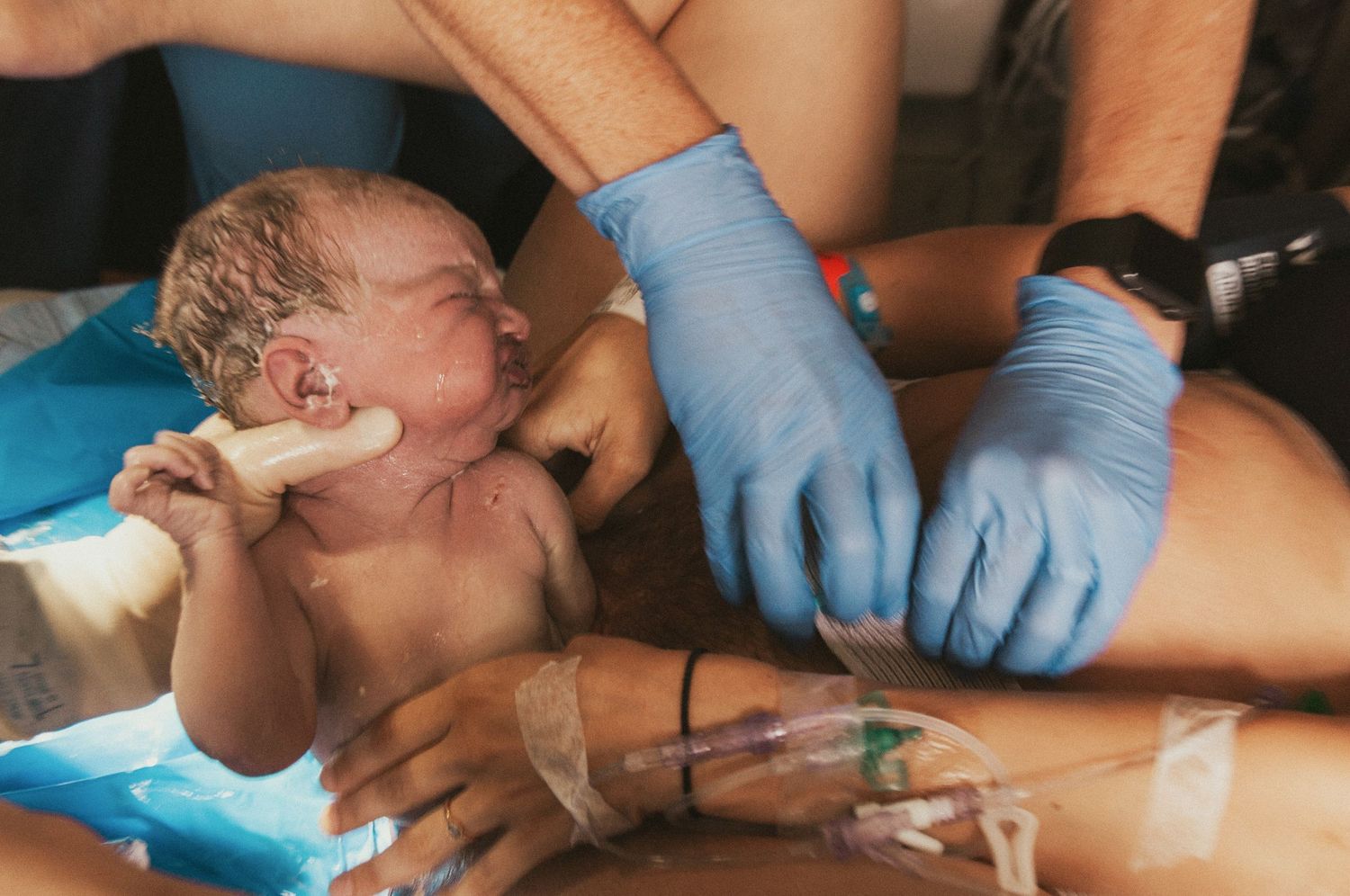 Medical team assisting with newborn baby delivery, infant held by gloved hands.