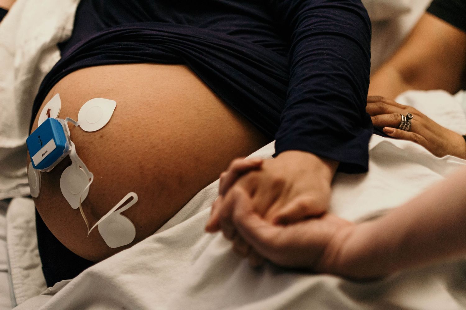 Close-up of pregnant belly with TENS machine electrodes attached for natural labor pain relief. top rated RI birth photographer