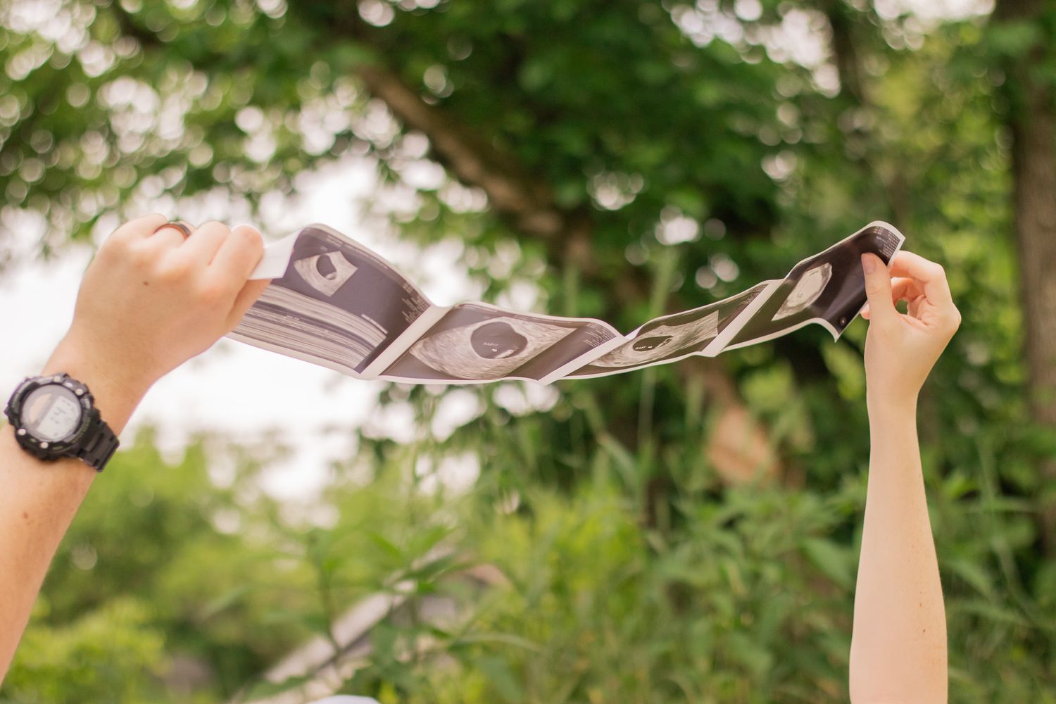 Hands holding up a string of dollar bills against a blurred green nature background.