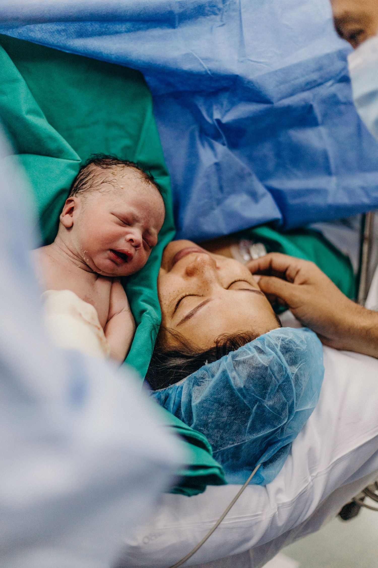 A newborn baby lies on a hospital bed during delivery, surrounded by medical drapes and equipment.