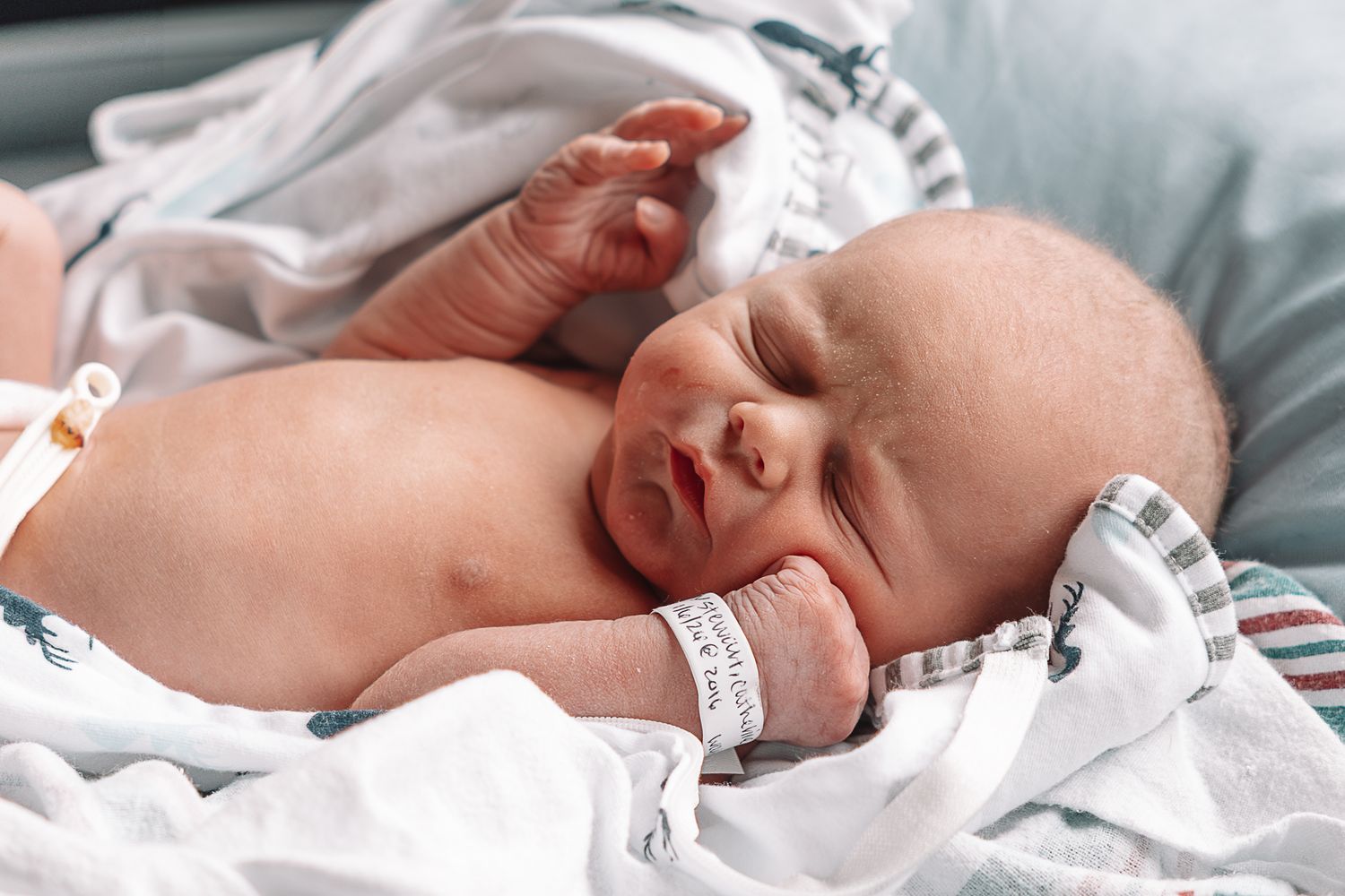A newborn baby rests peacefully on white hospital bedding wearing an identification bracelet.