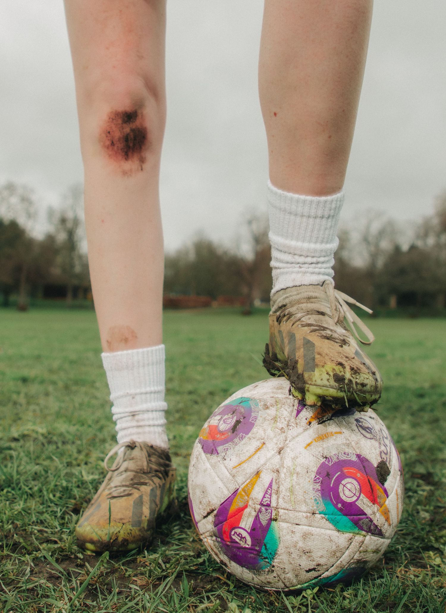 Muddy soccer cleats resting on a worn football, with a bruised knee visible on a grass field.