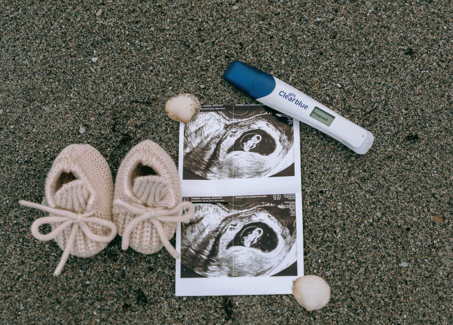Baby booties, ultrasound photos, and a positive pregnancy test arranged on sandy beach with seashells.