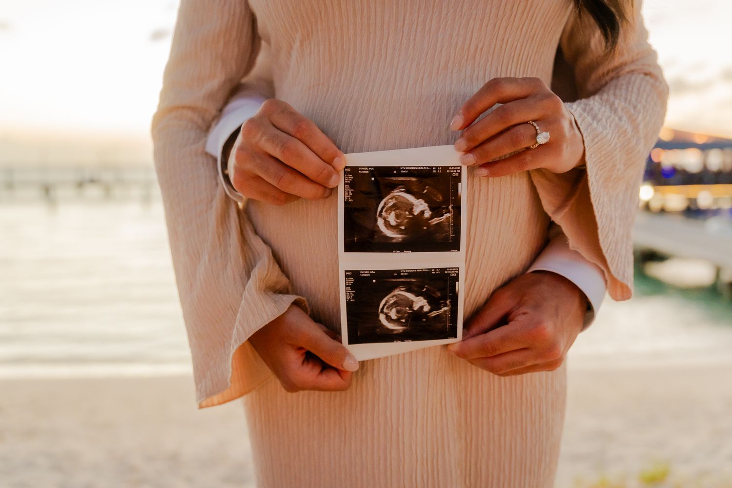 Maternity Photoshoot