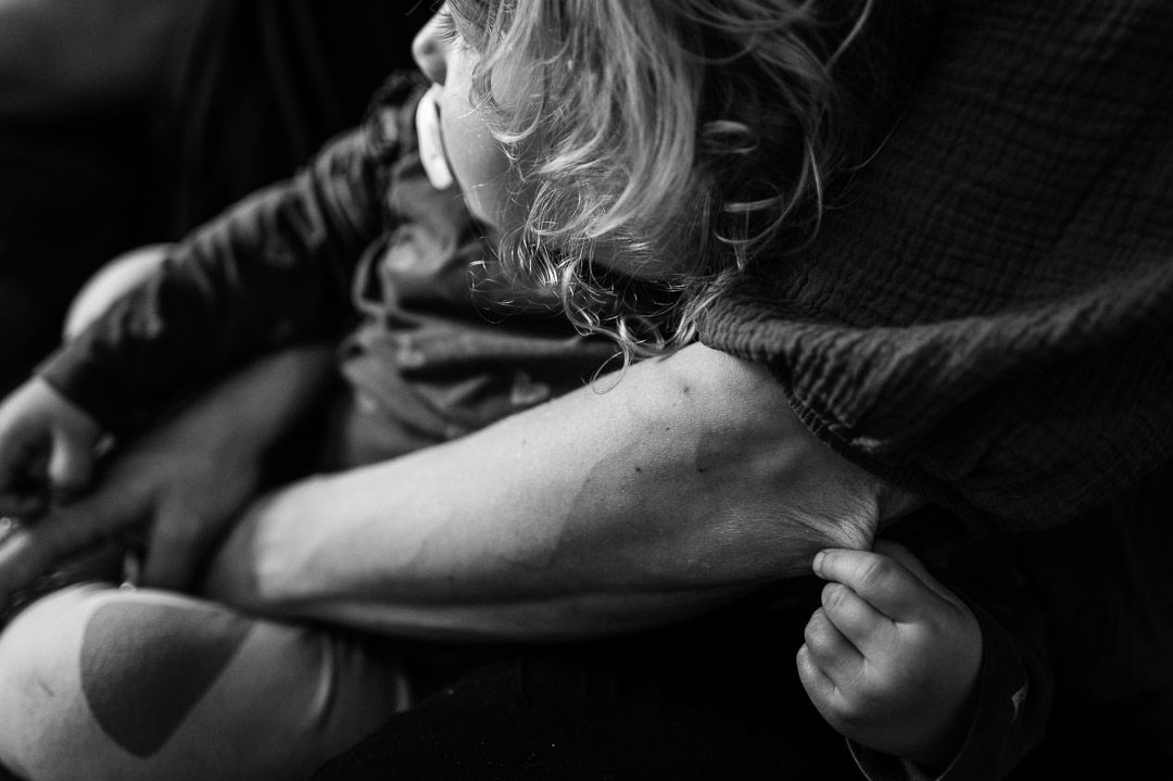 Kleinkind zwickt in Ellebogen der Mutter