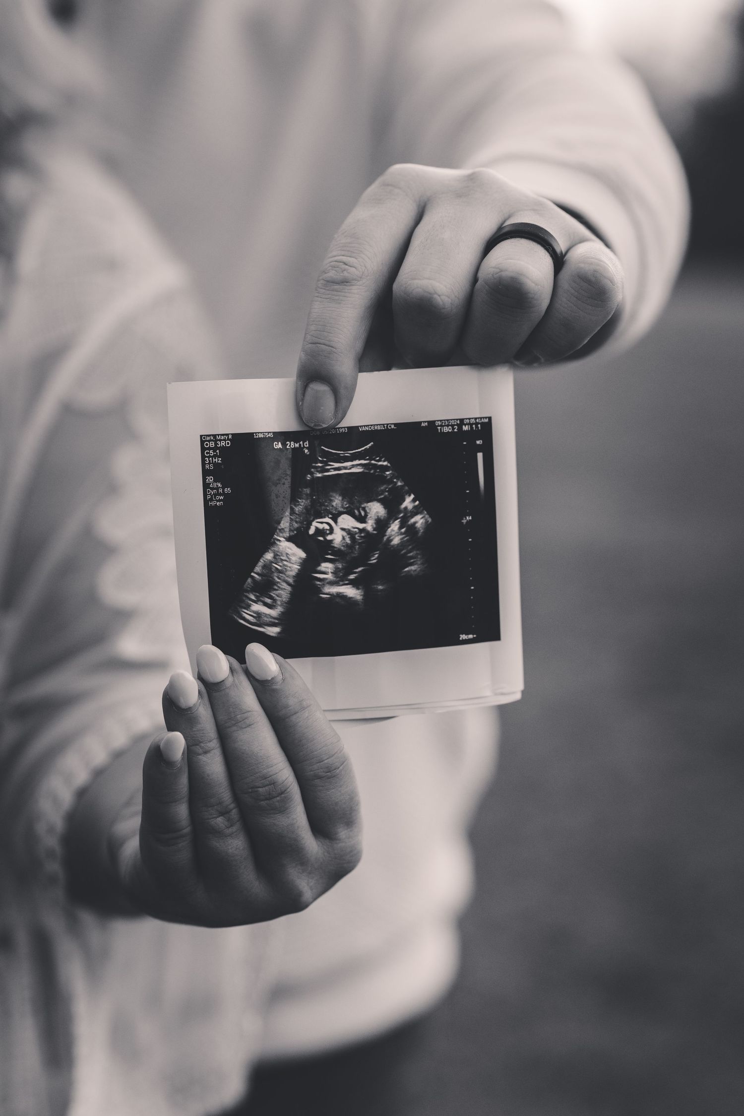 Black and white photo of couple holding ultrasound sonogram image, pregnancy announcement with wedding ring visible.