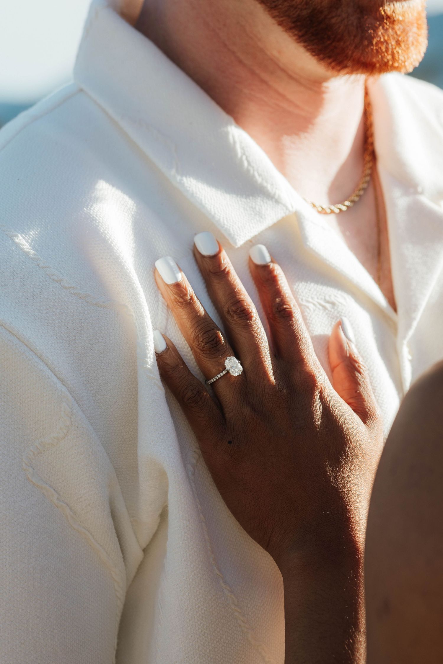 Close-up of a woman's hand with white nails and diamond engagement ring resting on a man's white shirt.