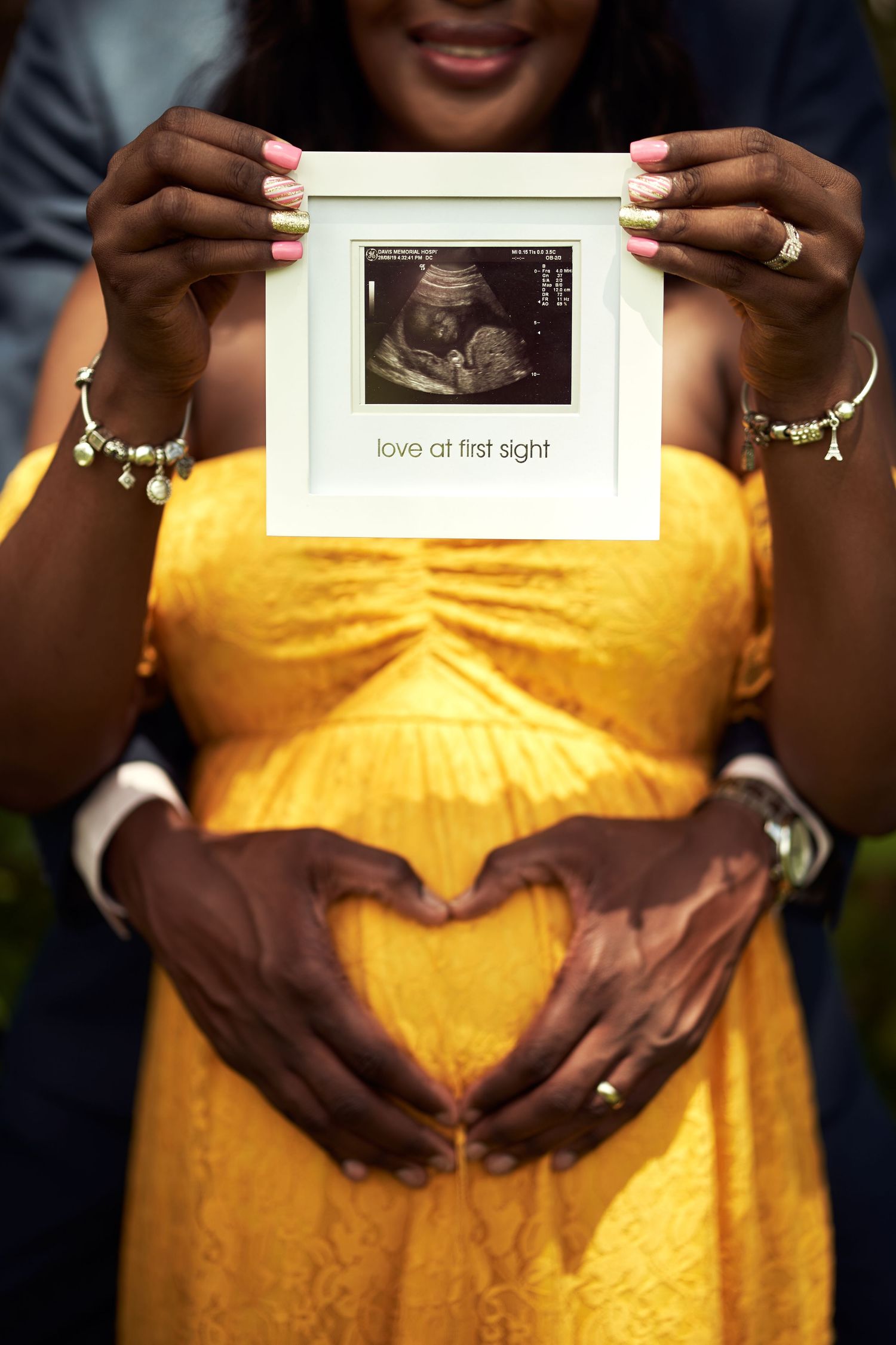 Maternity photo series showing hands holding ultrasound photos while wearing a yellow dress.