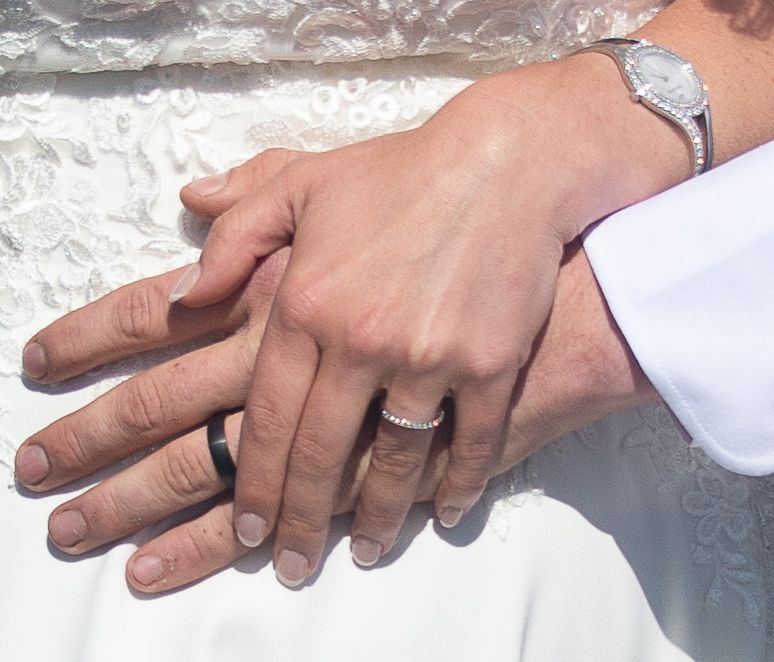 Two hands wearing wedding rings rest together on white lace fabric.