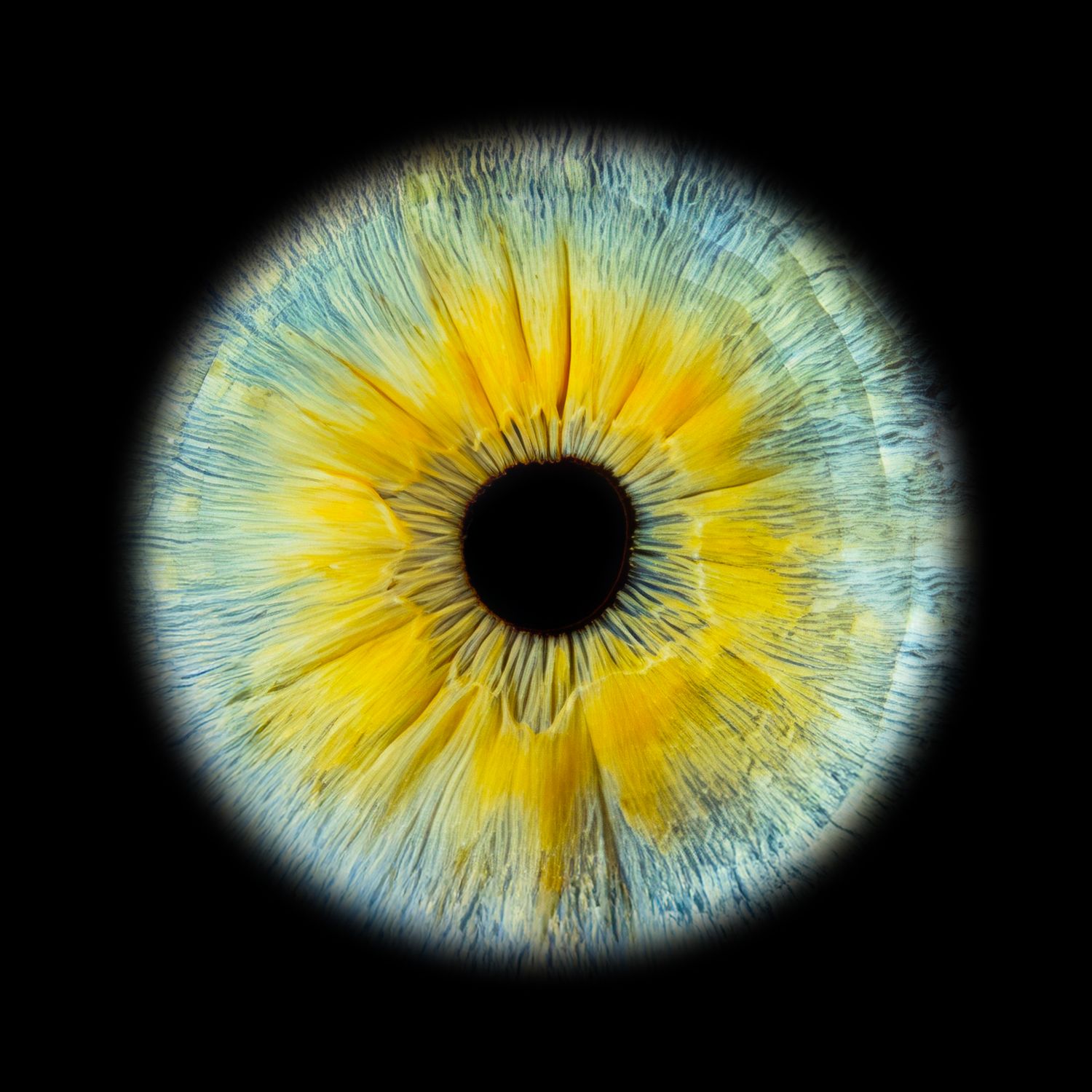 Close-up macro photograph of a human eye with a striking yellow and blue iris on a black background.
