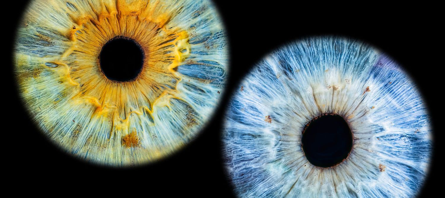 Two contrasting macro photographs of human irises in blue and yellow tones side by side.