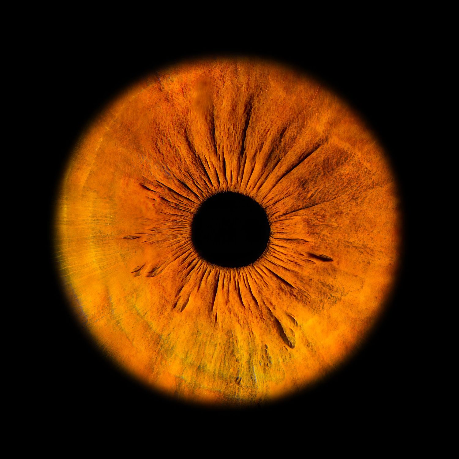 Close-up macro photo of a vibrant orange and yellow human iris with detailed texture on black background.