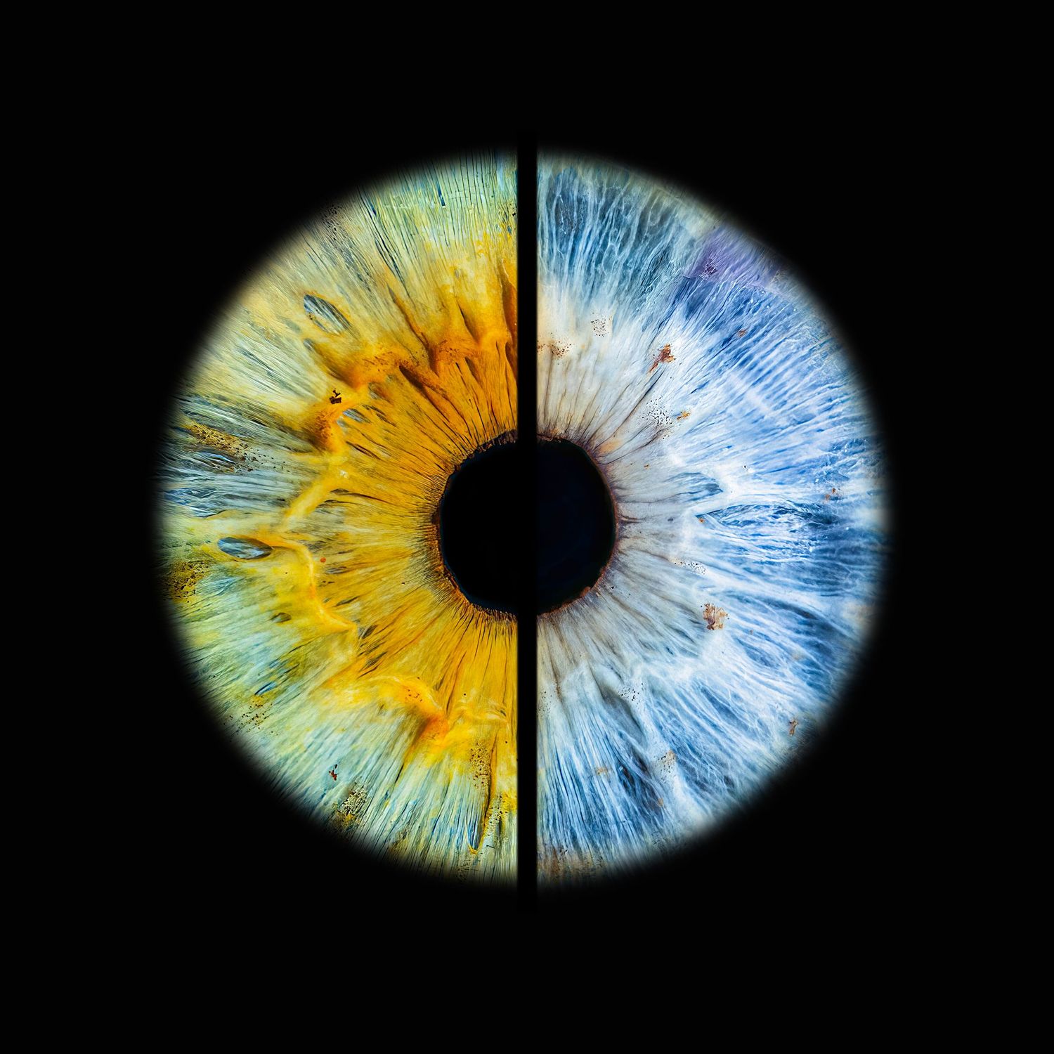 Close-up artistic photograph of a human iris split into contrasting yellow and blue halves against a black background.