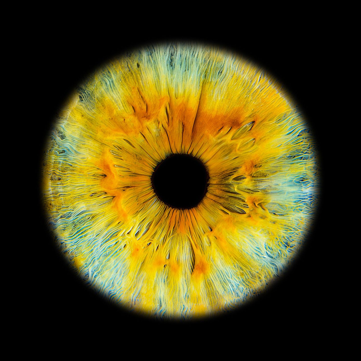 Close-up macro photograph of a stunning yellow and blue human iris with intricate fiber patterns on black background.