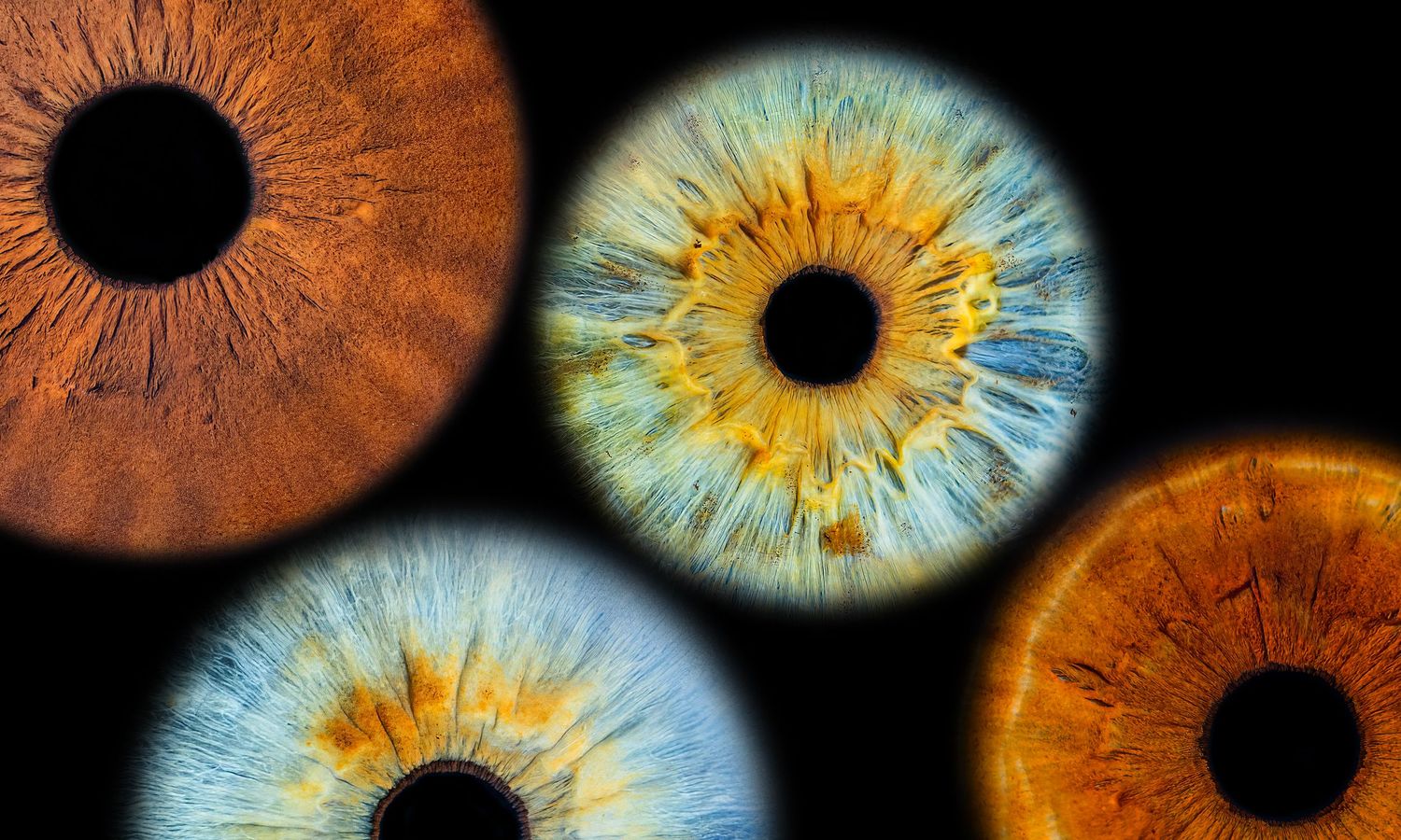Four vibrant iris macro shots showing orange and blue eye colors on black background.