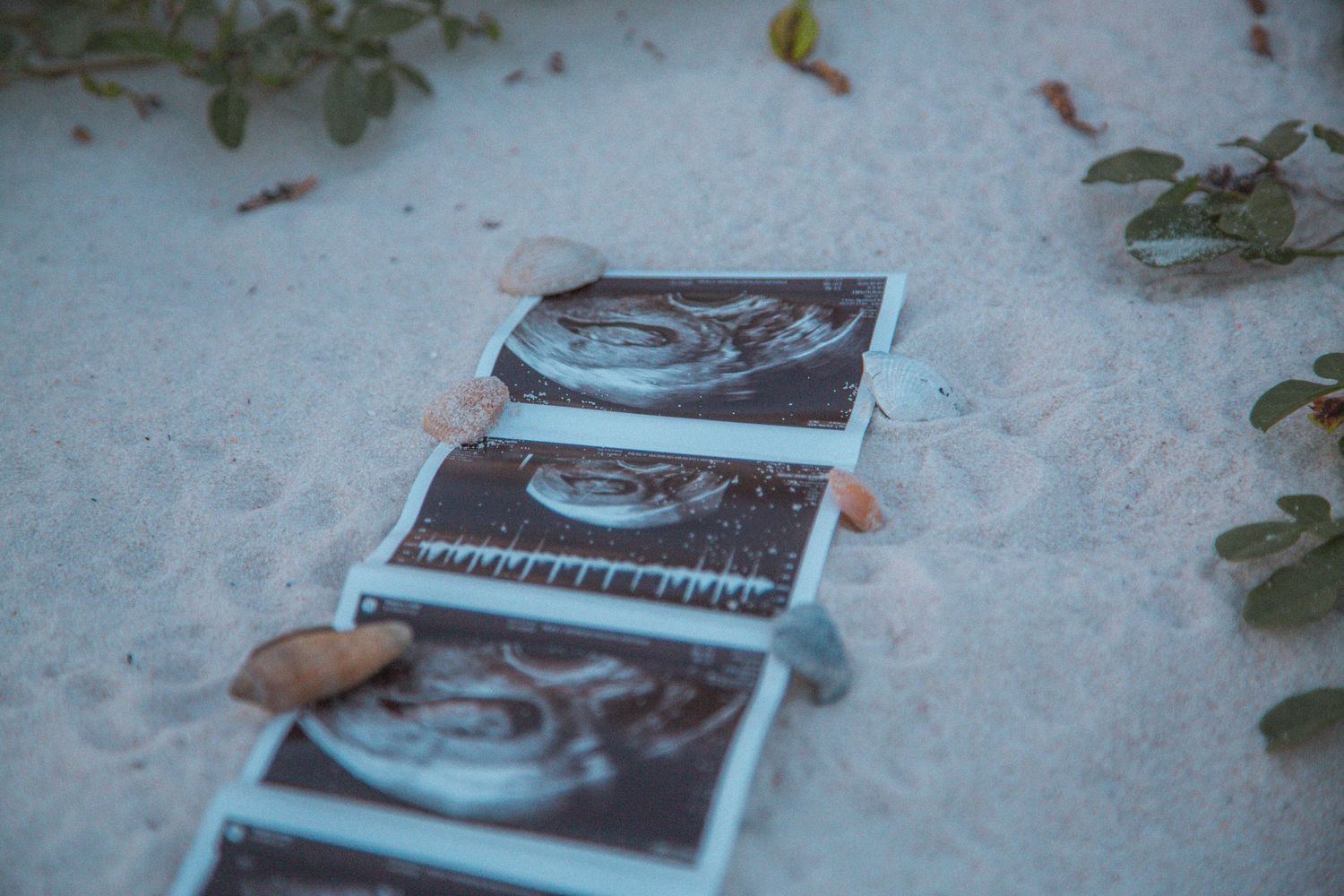 Ultrasound photos laid out on white sand beach surrounded by small green plants.