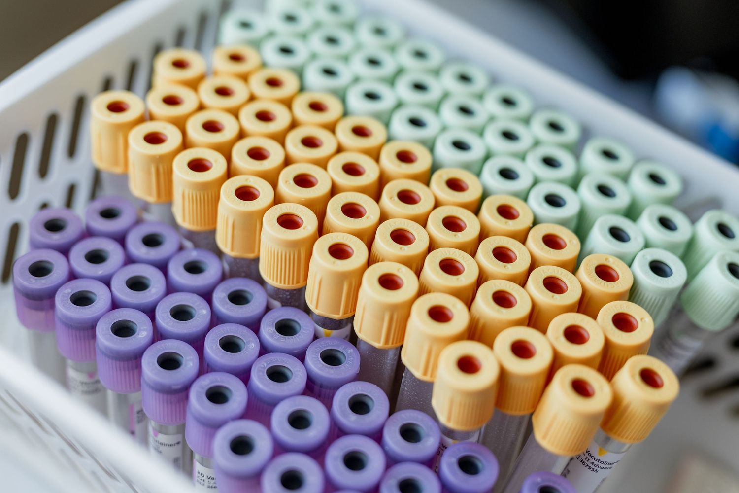 Colorful medical blood collection tubes organized in rows in a laboratory tray for diagnostic testing.
