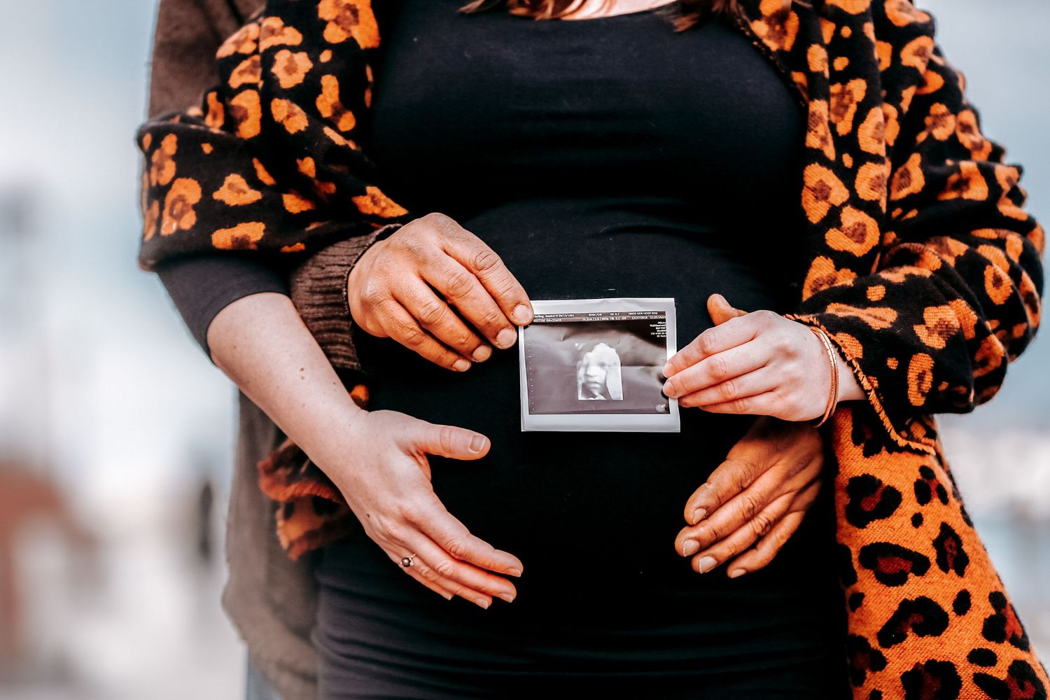 Pregnant woman in leopard print jacket holding ultrasound photo against baby bump outdoors.