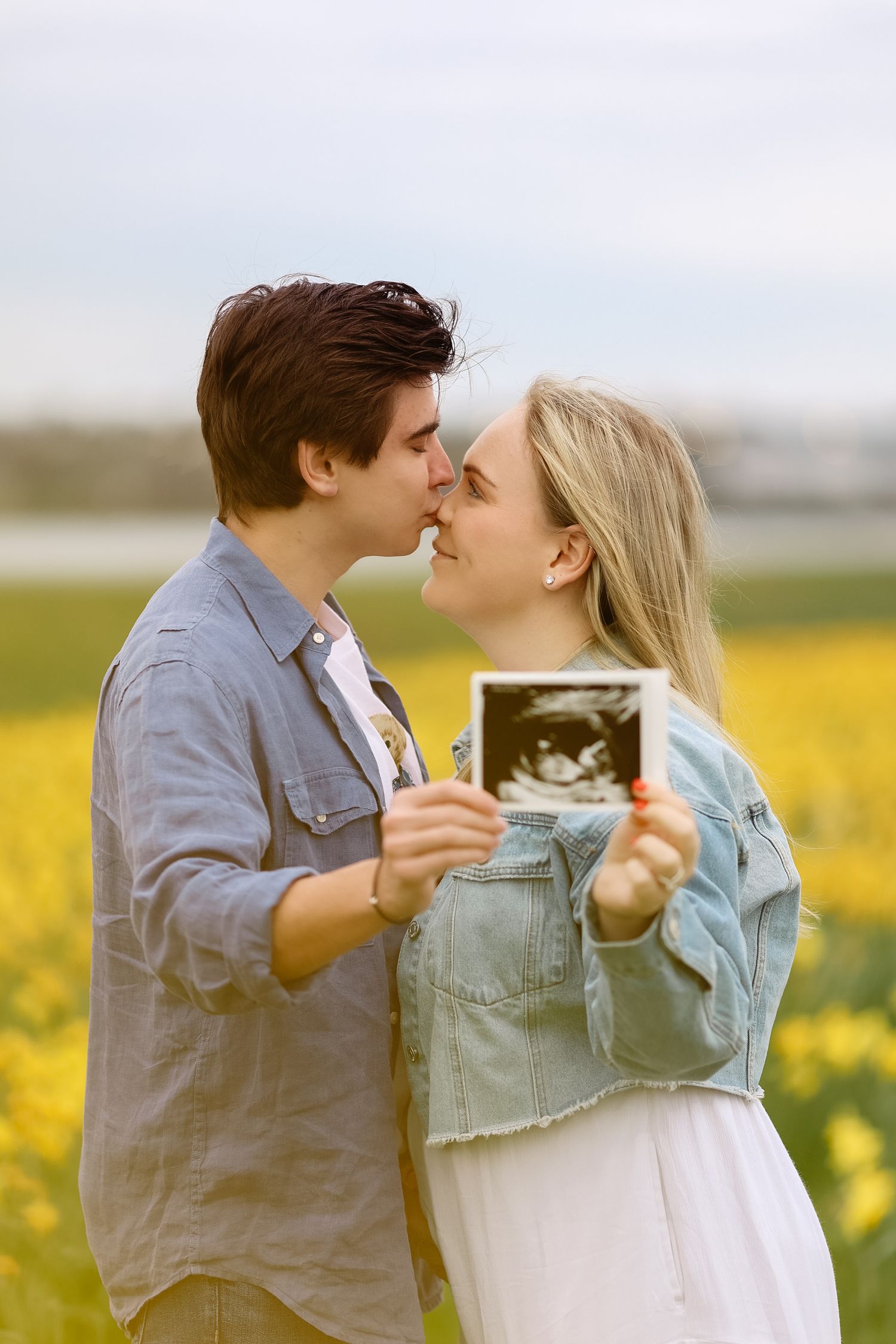Young couple kissing while holding ultrasound photo in a vibrant yellow daffodil field during pregnancy announcement.