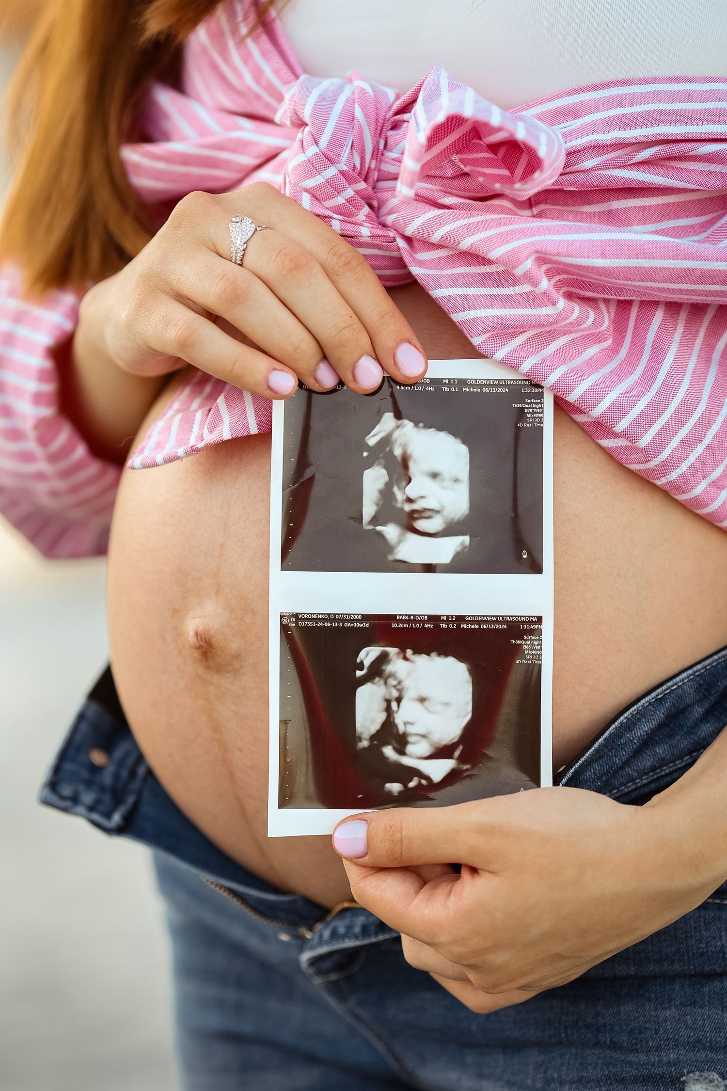 Pregnant woman in pink striped shirt holds ultrasound photos against her bare baby bump outdoors.