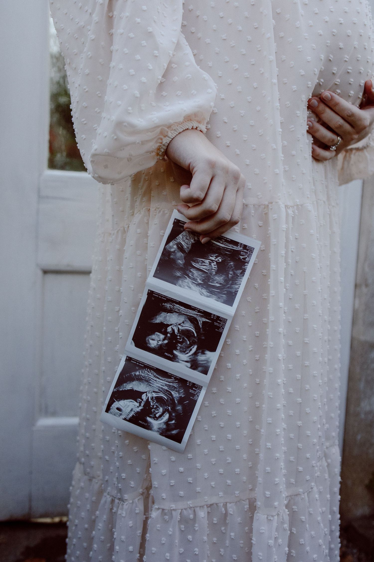 Someone in a white lace dress holds ultrasound photos, suggesting a pregnancy announcement or maternity moment.
