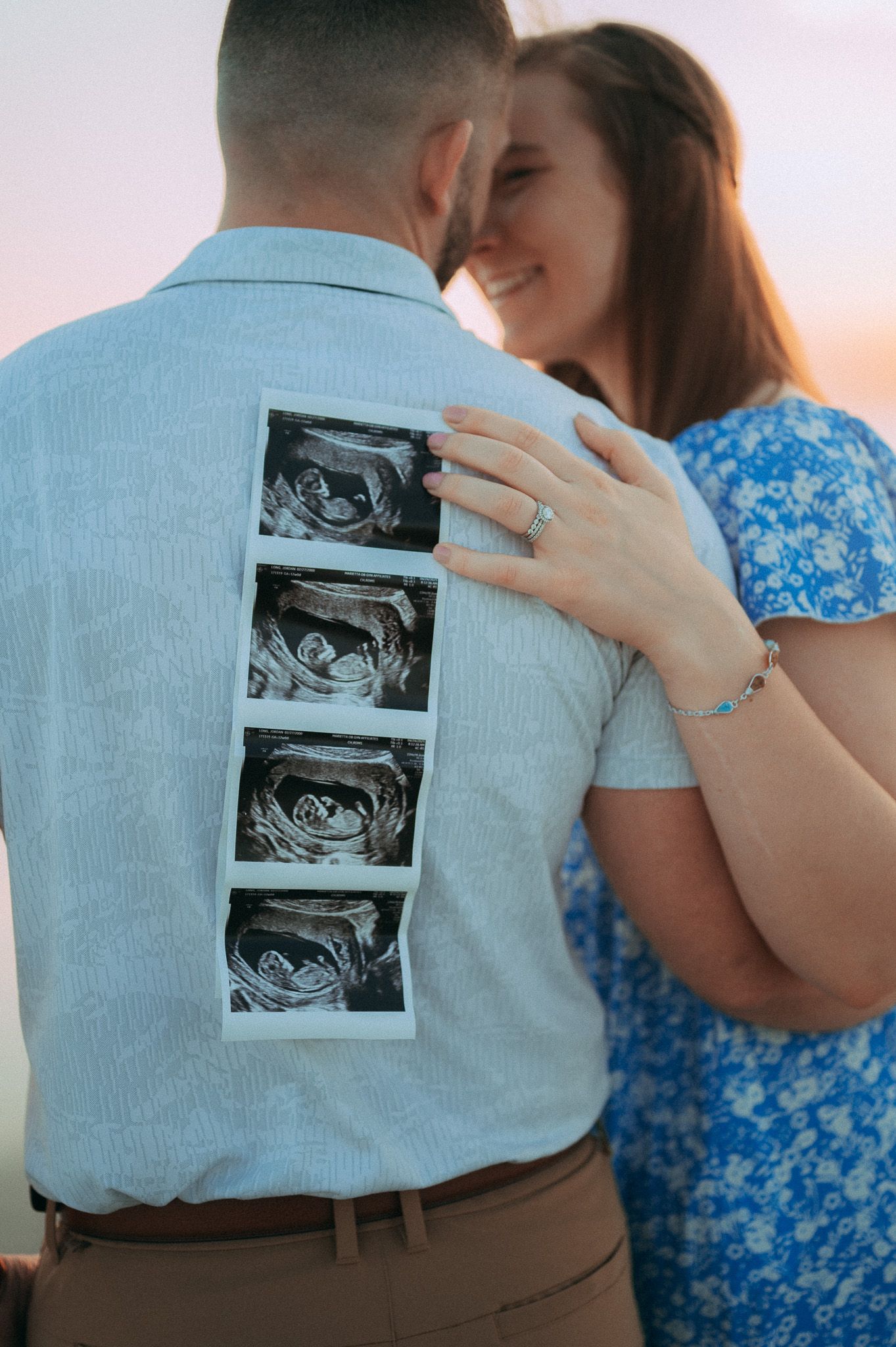 Couple embracing outdoors with ultrasound photos on mans back announcing pregnancy, woman wearing engagement ring.