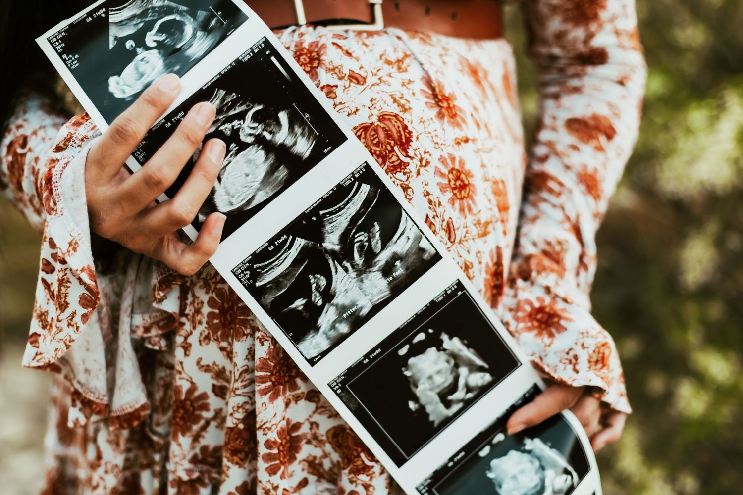 A strip of ultrasound sonogram photos held against a floral patterned dress in natural outdoor lighting.
