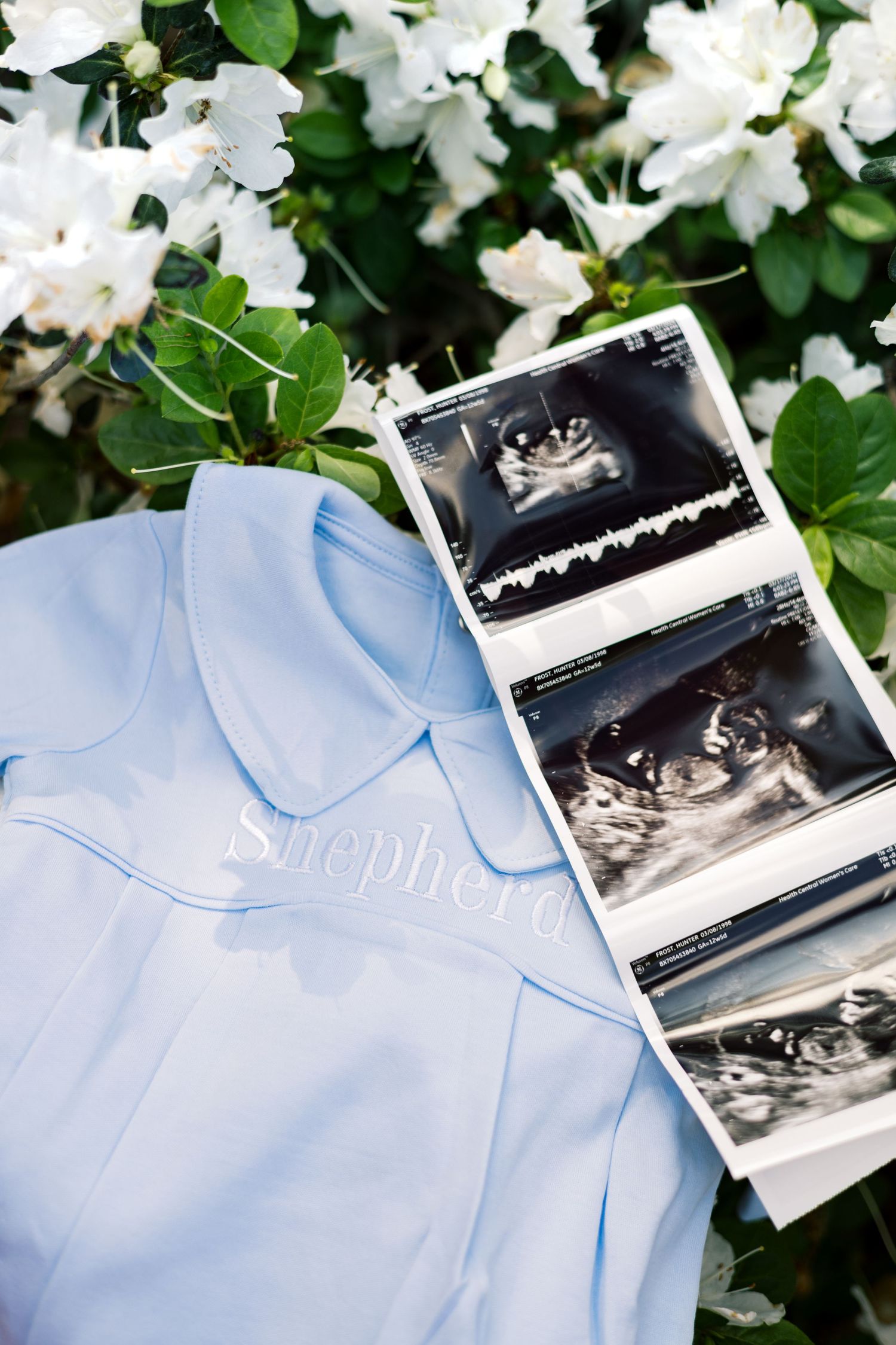 Blue baby onesie with name Shepherd beside ultrasound sonogram photos on white flowering bush backdrop.