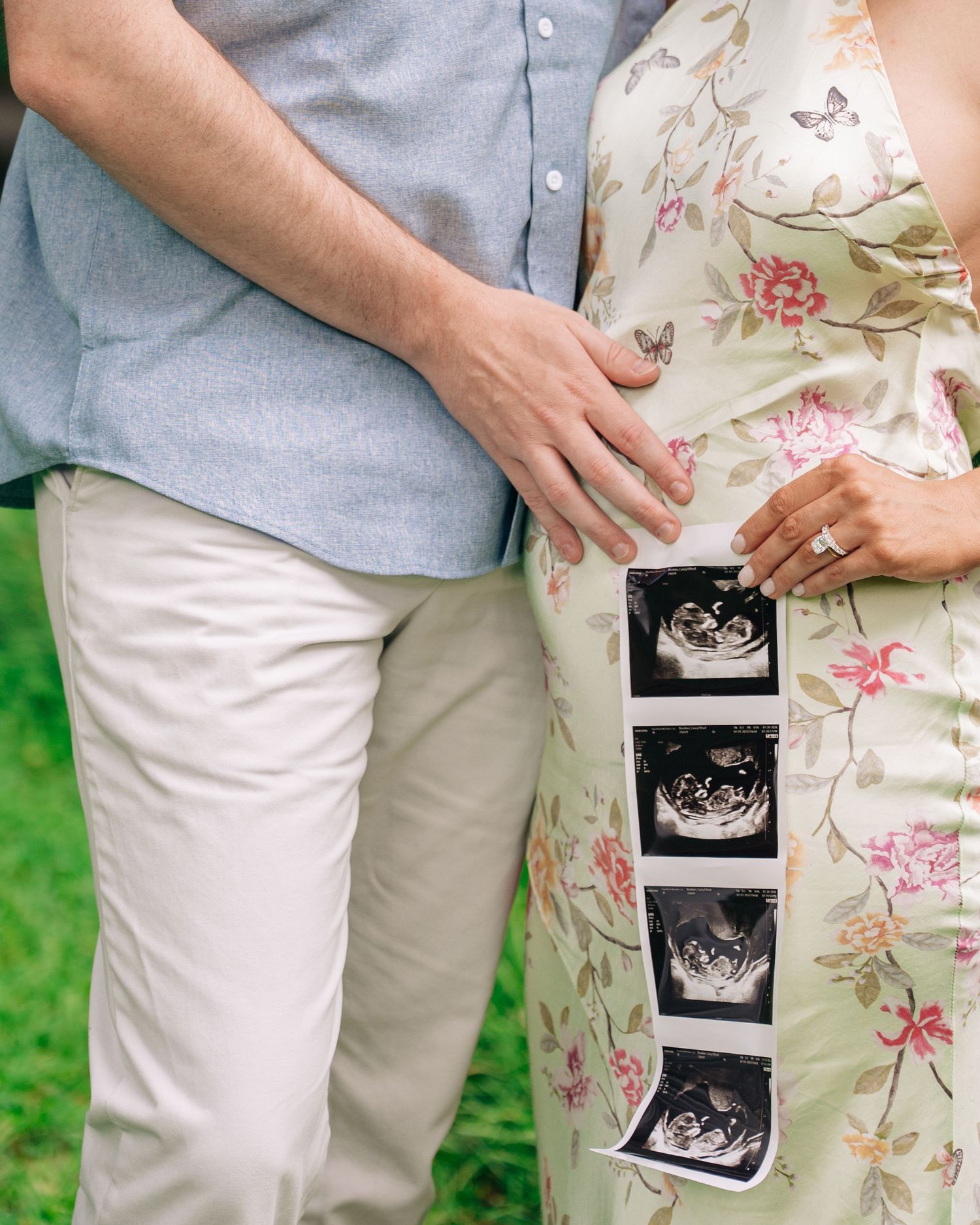 Pregnant couple holding ultrasound photos outdoors, woman in floral dress with partner in blue shirt and khakis.