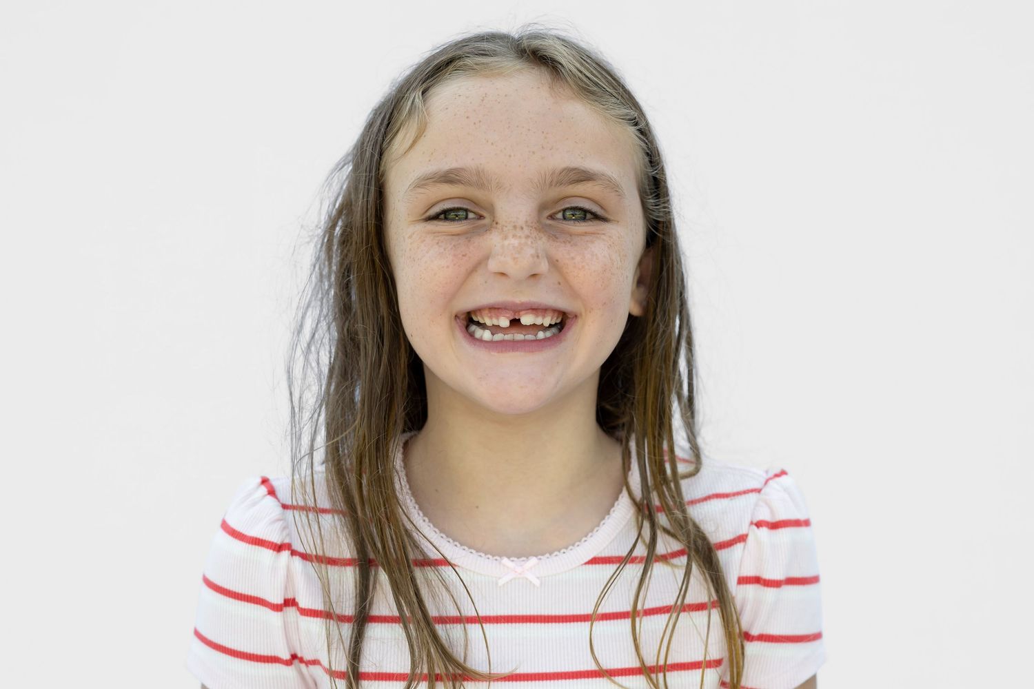 Smiling young girl with freckles and wet hair, missing front teeth, wearing a red striped shirt on white background.
