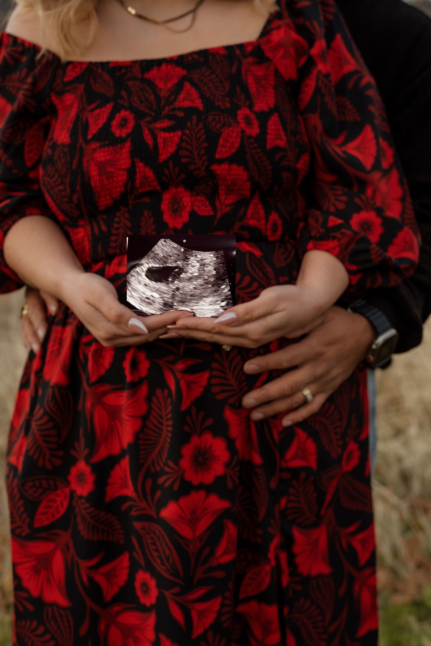 Hands holding ultrasound photos against a red and black floral dress.