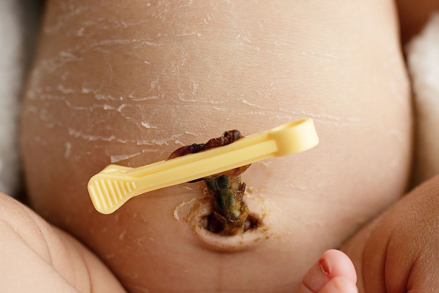 umbilical cord, close up detail baby photos, natural, raw, beautiful, congratulations, new parents, vietnamese and Fiji indian parents