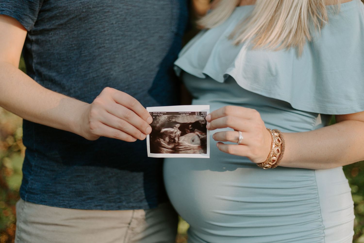 A couple shares an intimate moment while holding ultrasound photos in soft natural lighting.