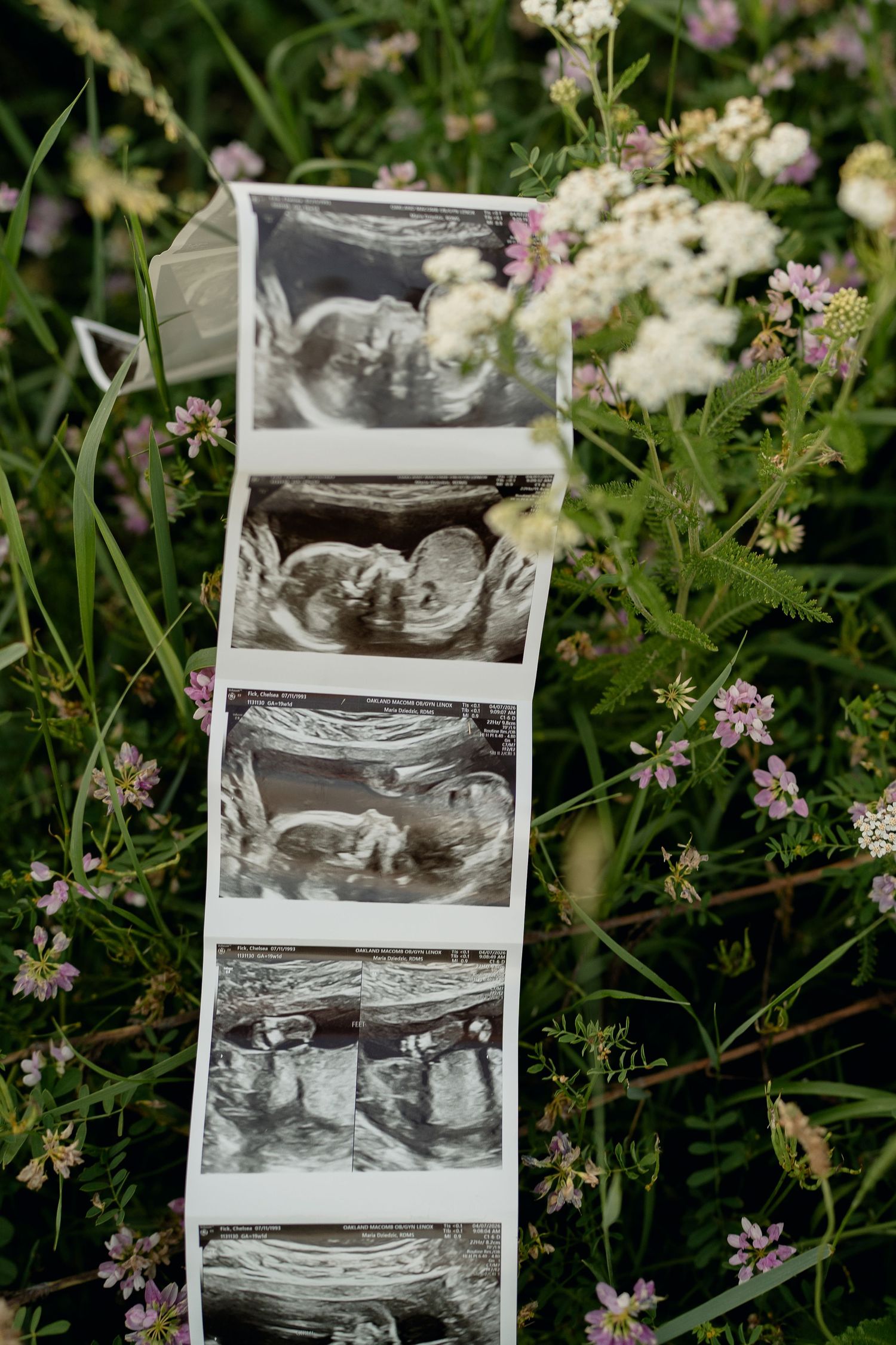 Strip of baby ultrasound photos displayed among wildflowers in a garden.