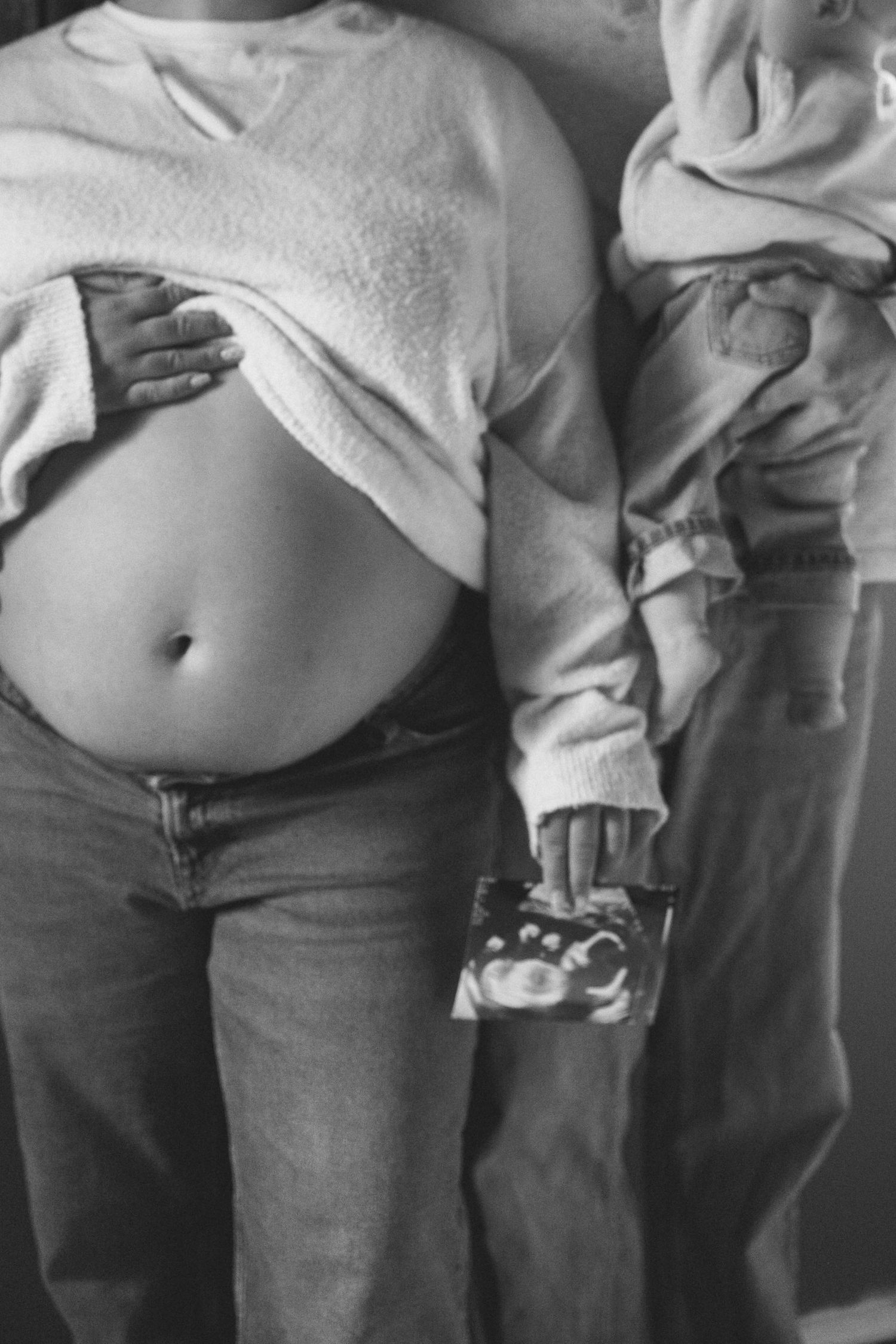 Black and white photo showing a person's exposed belly with a white shirt pulled up and jeans.