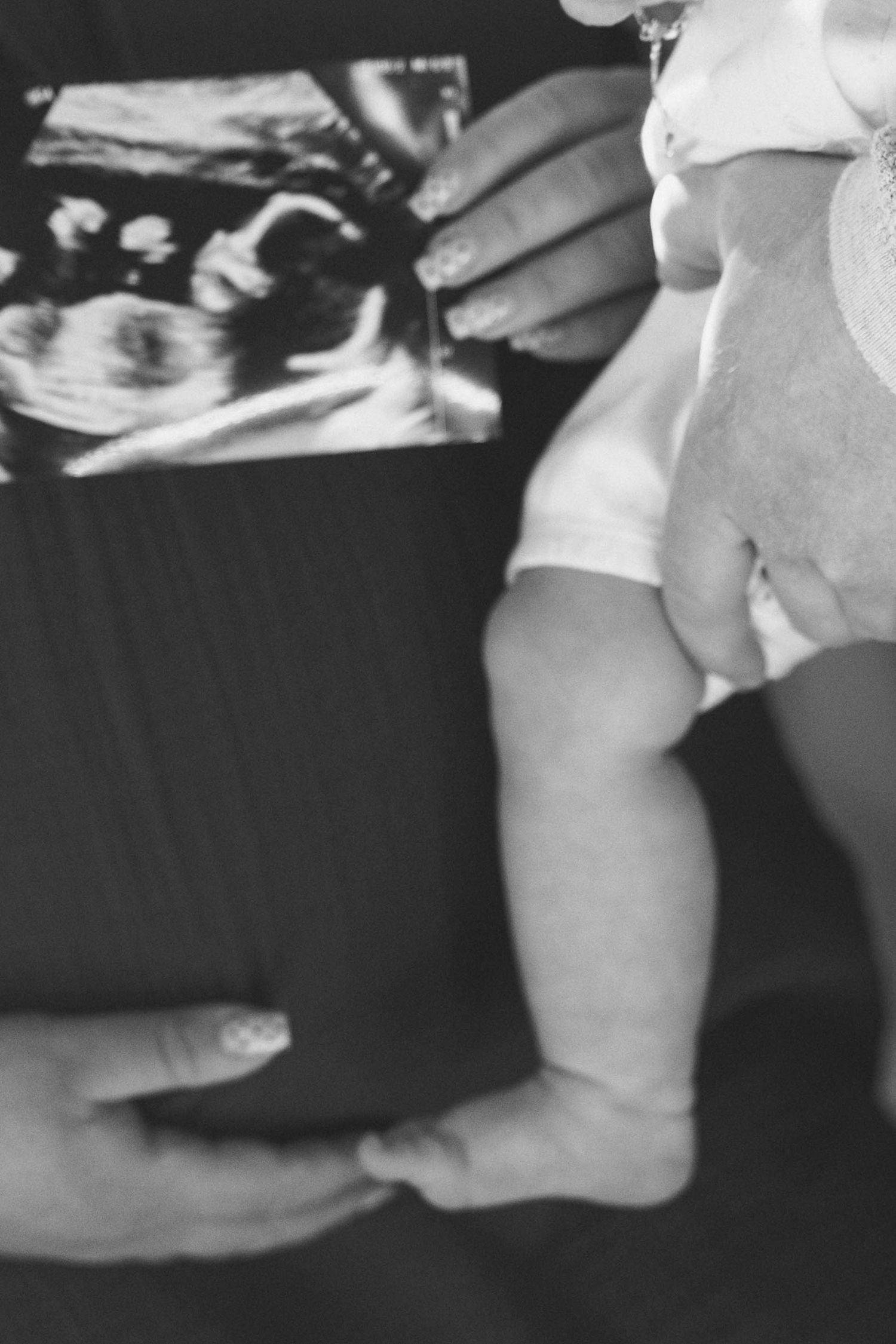 Black and white close-up images showing hands in various positions demonstrating a medical procedure or examination.