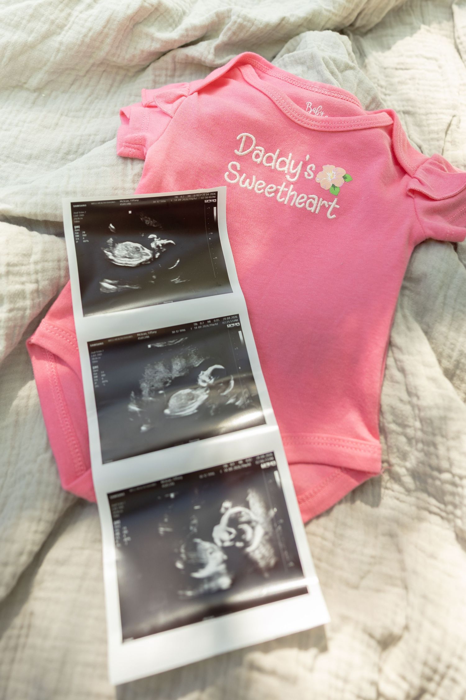 Baby ultrasound photos beside a pink Daddy's Sweetheart onesie on white fabric for gender reveal.