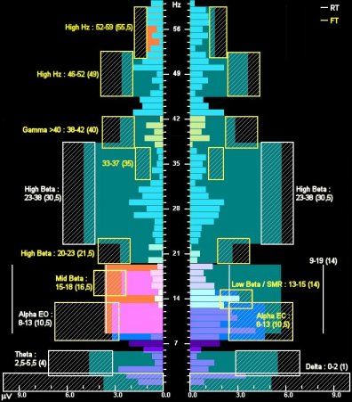 A series of technical diagrams showing blue and purple data visualization charts with vertical bars and measurement scales.