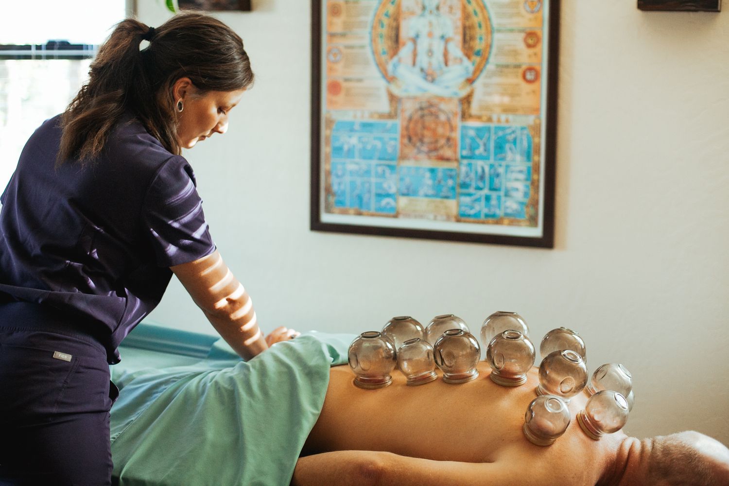 Traditional cupping therapy treatment being administered with multiple glass cups on the back.